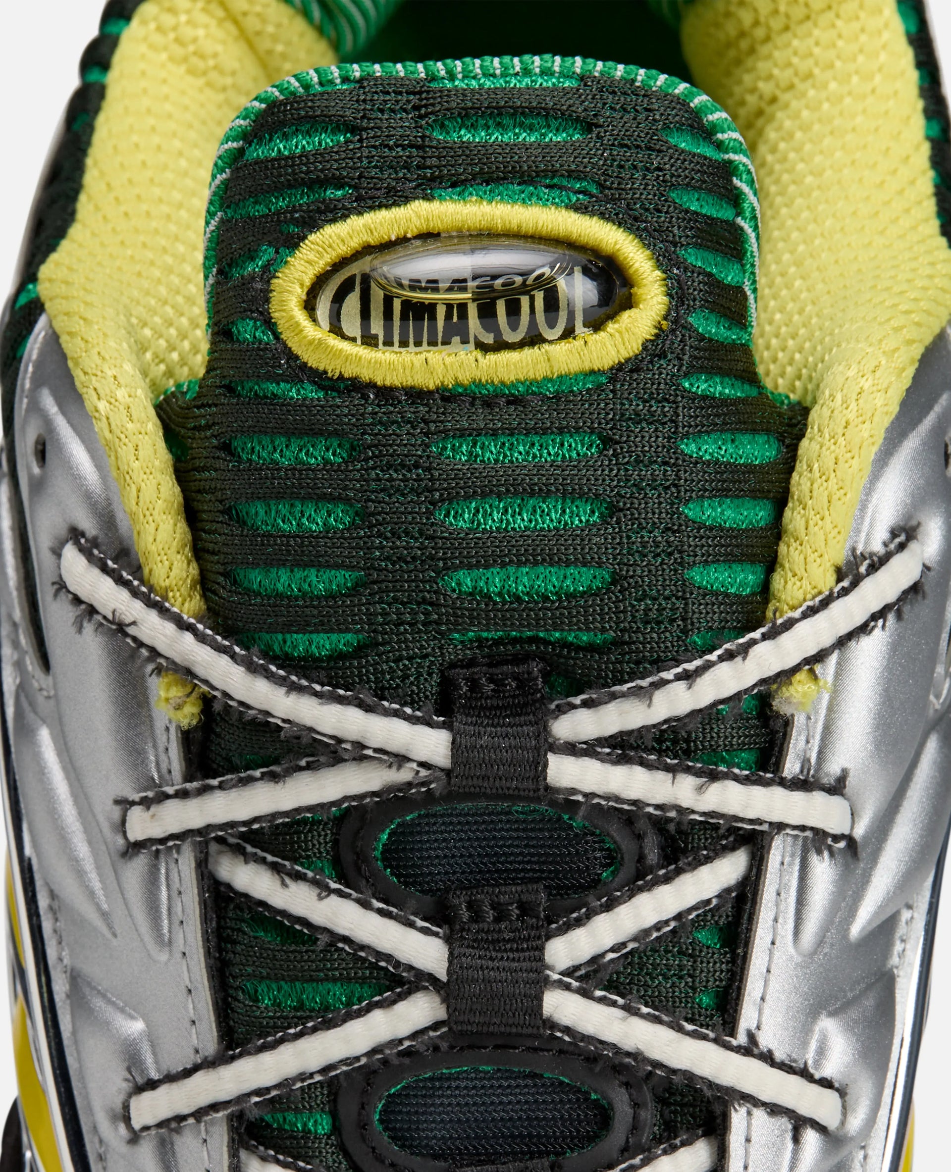 adidas X Brain Dead (Core Black/Impact Yellow/Silver Metal) adidas